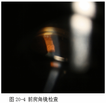 ZY016_102_5.gif